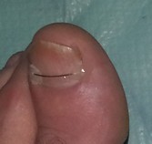 fin