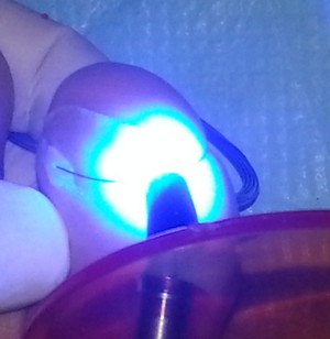 photopolylerisation